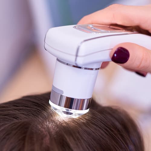 Especialistas en diagnóstico capilar en Pontevedra